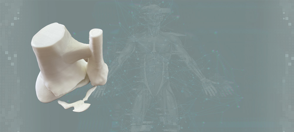 Анатомическая модель тибиальной части коленного сустава