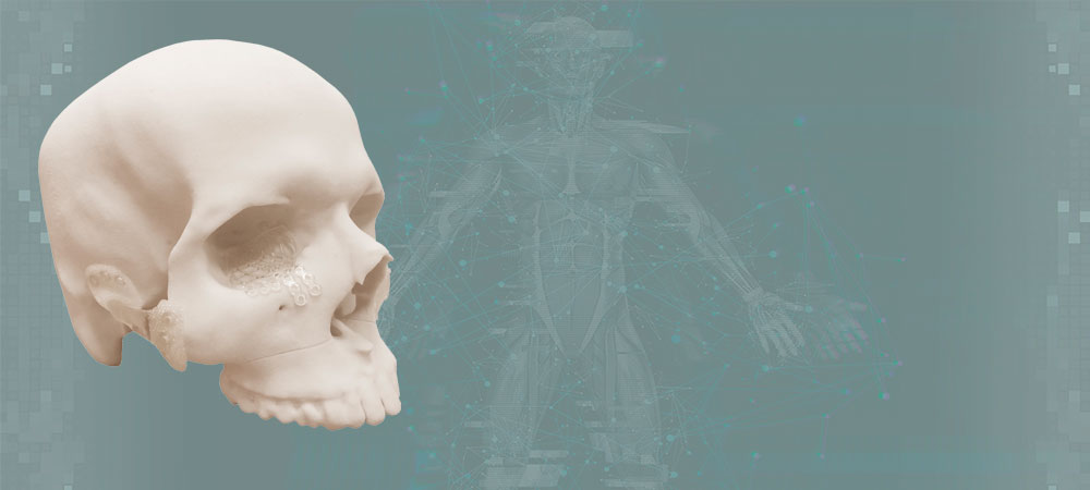 Anatomical skull display model with orbital floor and zygomatic bone implant replicas