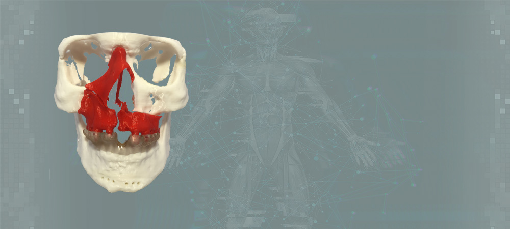 Анатомическая модель черепа с дефектом