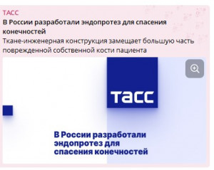 В России разработали эндопротез для спасения конечностей - новости с сайта ТАСС
